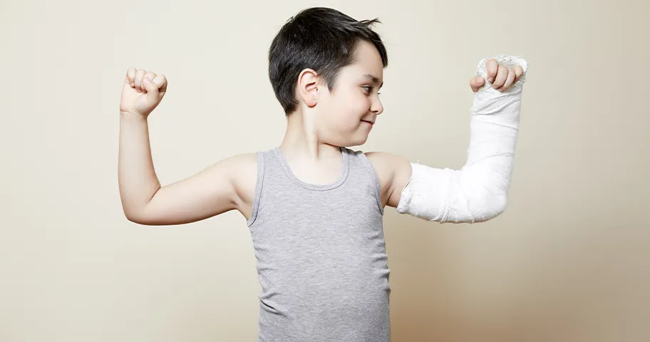 Kid flexing his muscles with cast on broken arm.